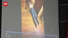 VIDEO: Komnas HAM Ungkap Foto Jasad Brigadir J 1 Jam Usai Penembakan