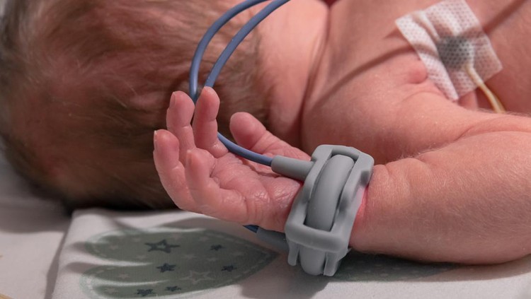 Premature baby hand with a premature infant pulse oximeter, selective focus. Newborn is placed in the incubator, baby born prematurely. Neonatal intensive care unit