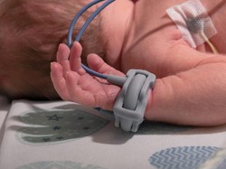 Bayi Perempuan di Palembang Meninggal Dunia Diduga Usai Suntik Imunisasi