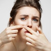 Jangan Salah Lagi, Kenali Jenis-jenis Jerawat Pada Wajah dan Cara Tepat Mengatasinya Yuk!