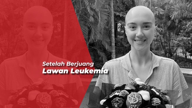 YouTuber Sara Holmes Meninggal Dunia, Tinggalkan Pesan untuk Fans