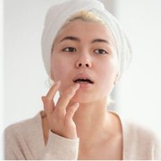 Bibir Kering dan Sering Pecah-Pecah? Ini 7 Penyebab dan Cara Mengatasinya!