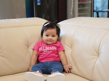 Ameena Didiagnosis Eksim, Aurel Hermansyah: Punya Kulit Super Sensitif