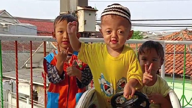 Lewat BerbuatBaik.id, Anda bisa membantu Muhammad Ar Rasyid, bocah penderita sindrom langka Apart Sindaktili.
