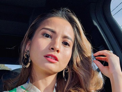 3 Seleb Tanah Air Hidup dengan Satu Ginjal, Acha Septriasa Baru Tahu saat Dewasa