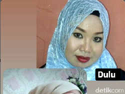 Pengakuan Wanita yang Viral Setelah Glow Up, Bikin Kaget bak Beda Orang