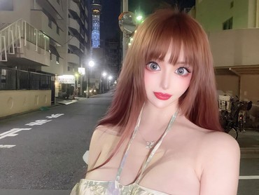 Wanita Ini Obsesi Jadi Boneka Prancis, Oplas hingga Implan Payudara Ukuran M
