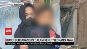 VIDEO: Tak Sengaja Tertelan, Anak Kunci Berada dalam Perut Bocah