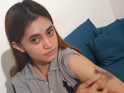 Polwan Sekap-Pukuli Wanita di Pekanbaru Jadi Tersangka