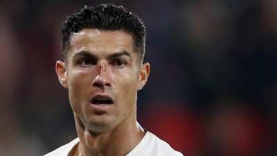 Rapor Ronaldo di Ceko vs Portugal: Nirgol, Hidung Bercucuran Darah