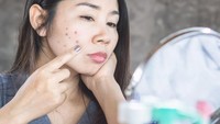11 Cara Menghilangkan Flek Hitam Secara Alami, Mudah Dicoba di Rumah