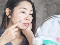 Bikin Wajah Glowing! 7 Makanan Ini Ampuh untuk Pudarkan Flek Hitam