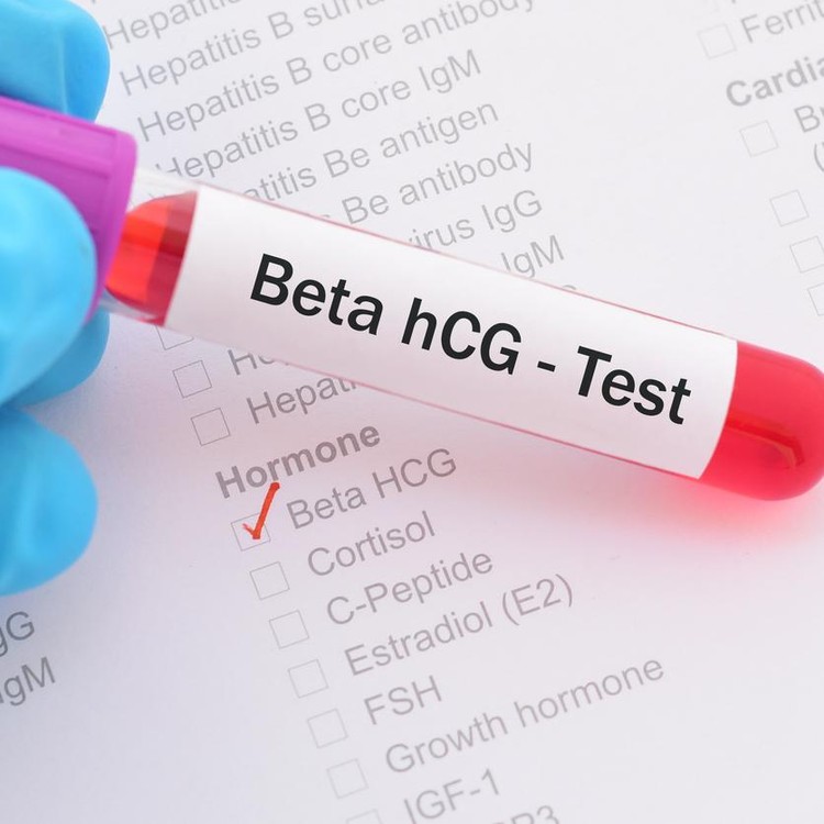Blood sample for beta hCG hormone test