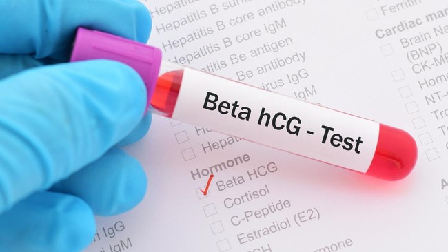 Apa Itu Hormon Beta Hcg Apa Itu Hormon Beta Hcg