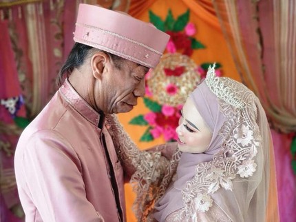 Mengidap Sindrom Langka, Surya Manurung Bersyukur Dapat Istri Berhati Tulus