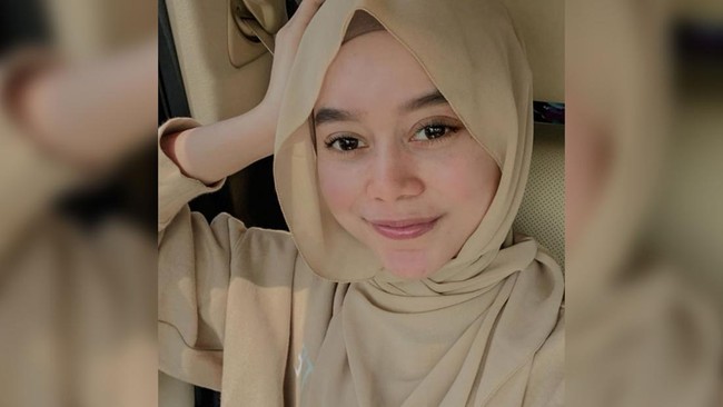 Penyanyi dangdut Lesti Kejora mengalami luka memar dan lebam di bagian leher hingga telapak tangan atas dugaan KDRT yang dilakukan Rizky Billar.