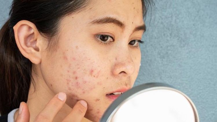 Apakah Boleh Tidak Memakai Skincare