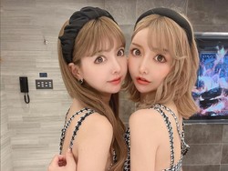 Saudara Kembar Oplas Biar Makin Cantik dan Mirip, Perubahannya Mencengangkan