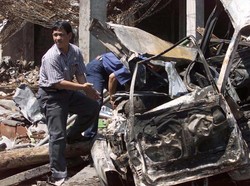 Australia Temukan Inovasi Perawatan Luka Bakar Setelah Tragedi Bom Bali