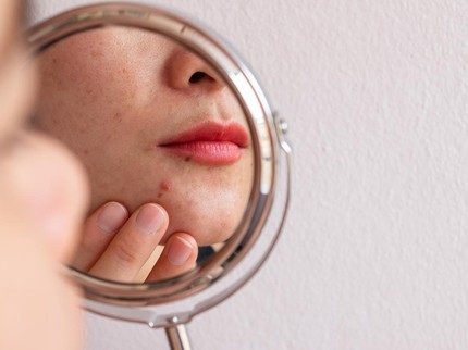 9 Kebiasaan Sehari-hari Penyebab Kanker Kulit, Termasuk Sering Makeup