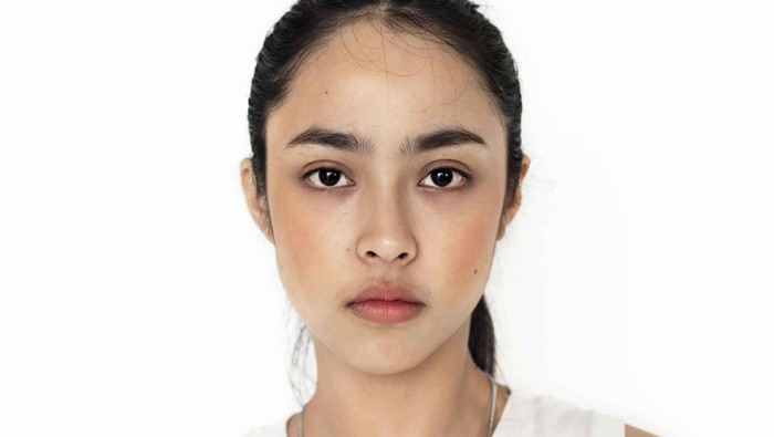 4 Cara Memperbaiki Kulit Belang Akibat Matahari dengan Cepat