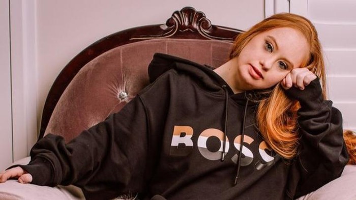 Kisah Madeline Stuart, Supermodel Down Syndrome dan Autisme yang Jadi Panutan & Inspirasi Banyak Orang