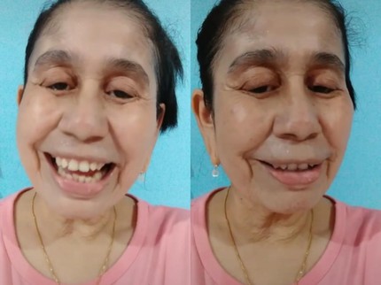 Cerita Wanita Dibully karena Wajahnya Seperti Lansia, Ternyata Idap Sindrom Langka
