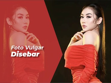 Punya Hubungan Toxic, Pamela Safitri Jadi Korban Kekerasan Eks Pacar