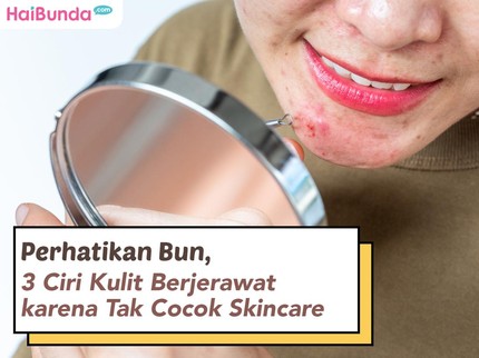Perhatikan Bun, 3 Ciri Kulit Berjerawat karena Tak Cocok Skincare