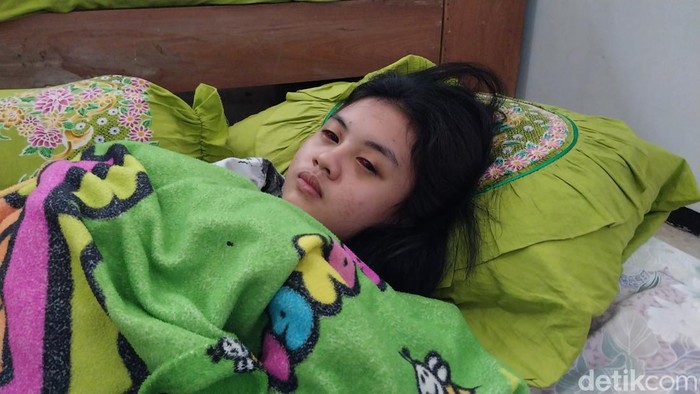 Ini Kisah Perempuan Asal Malang yang Menjadi Korban Tragedi Kanjuruhan, Hilang Ingatan dan Mata Memerah!