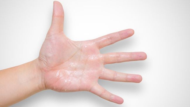 Tangan panas akibat cabai? Atasi dengan bahan dapur seperti minyak, susu, yogurt, hingga cuka. Praktis dan cepat meredakan perih.