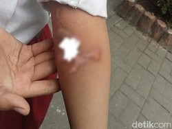 Bocah Yatim Piatu Gresik Dianiaya, Sering Kelaparan Minta Makan Tetangga