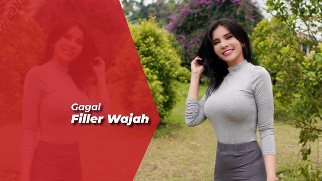 Korban Malapraktik, Maria Vania Kena Penyakit Saraf Sampai Tak Bisa Tertawa