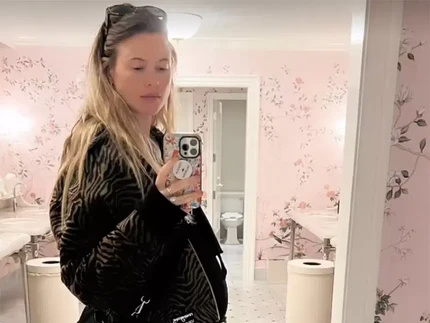 Behati Prinsloo Kembali Aktif di Medsos dan Bagikan Baby Bump Kehamilan Ketiga