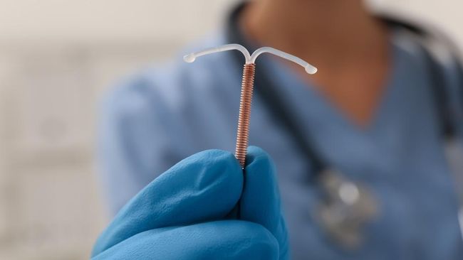 Hamil saat Pakai IUD? Simak Risiko dan Tindakan yang Perlu Dilakukan Menurut Pakar