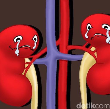 3 Gerakan Olahraga Sederhana untuk Penderita Gagal Ginjal