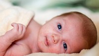 Bruntusan pada Bayi: Penyebab dan Cara Menghilangkannya dengan Obat Alami dan Kimia