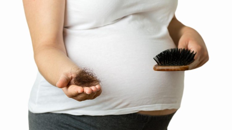 Ilustrasi Rambut Ibu Hamil Rontok Ilustrasi Rambut Ibu Hamil Rontok
