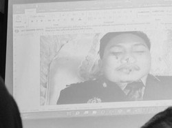 Potret Jenazah Yosua Ditampilkan di Sidang, Ada 2 Luka di Wajah