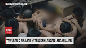 VIDEO: Tawuran, Dua Pelajar Nyaris Kehilangan Lengan dan Jari