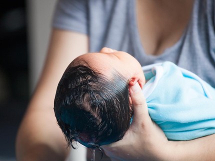 Rambut Bayi Rontok: Penyebab, Cara Mencegah, dan Mengatasinya