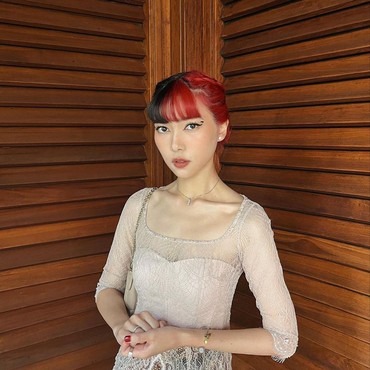 Didiagnosis Idap Lupus, Isyana Sarasvati: Sudah Semakin Membaik