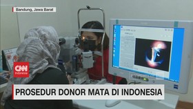 VIDEO: Prosedur Donor Mata di Indonesia