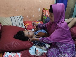 Kondisi Vicky Korban Kanjuruhan Sidoarjo: Tak Bisa Duduk-Makan Disuapi