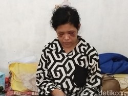 Lapangnya Hati Rohimah, ART Garut yang Disiksa Majikannya