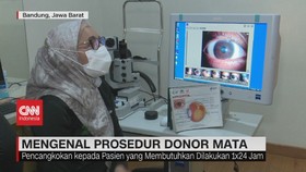 VIDEO: Mengenal Prosedur Donor Mata