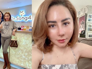 img-title 7 Potret Beda Femmy Permatasari Usai Oplas Hidung di Korea