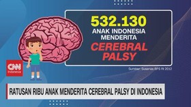 VIDEO: Ratusan Ribu Anak Menderita Cerebral Palsy di Indonesia