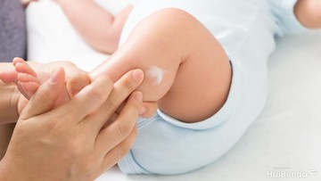 PENGGUNAAN SALEP UNTUK MENGHILANGKAN BEKAS LUKA ASI