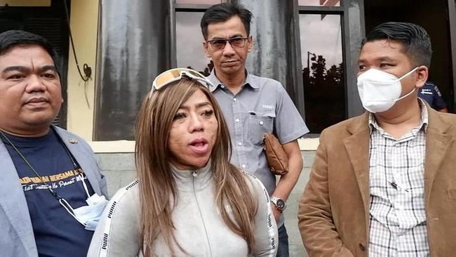 Atlet binaragawati asal Bandung, Anoy Roz, melapor polisi usai menjadi korban dugaan kekerasan oleh pengemudi ojek online yang kesal pesanannya dibatalkan